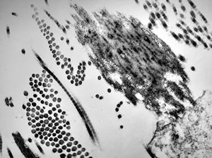 F,68y. | collagenous and elastin fibers from corium F,68y. | collagenous and elastin fibers from corium